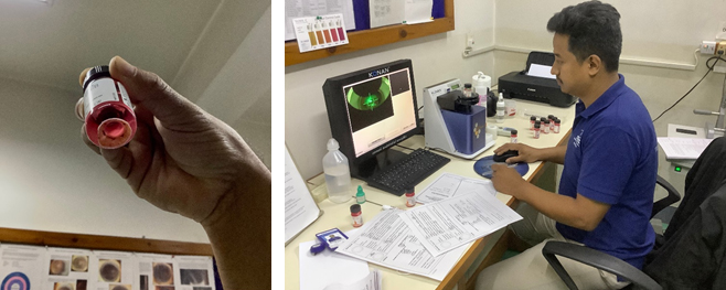 Cornea donation in Nepal