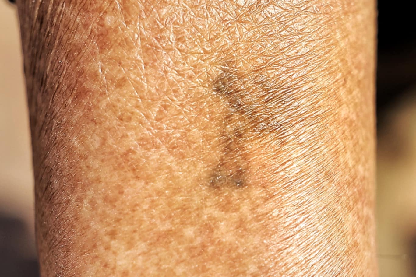 Skin art for the journey to afterlife NT