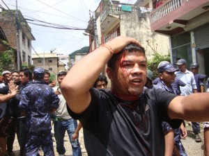 RSS Ashok Lamichane, who was injured during the clash.